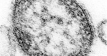 はしか感染確認の男性が訪れた万博パビリオン一覧　判明分は8カ所、大阪府が注意呼びかけ - 産経ニュース