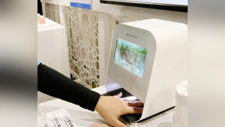 ＜チャレンジ！万博＞ねじれやにごり、ゴーストも…毛細血管見て健康チェック：地域ニュース : 読売新聞