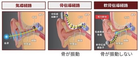 けいはんな学研都市に立地のCCHサウンドが 有線イヤホンの決定版・世界初※の軟骨伝導イヤホン 「サウンドボール(R)」発売！ | NEWSCAST