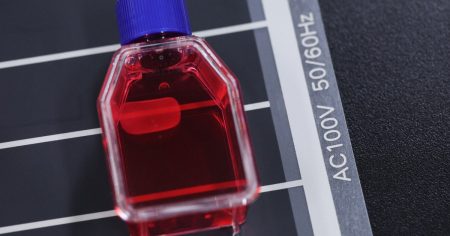 効果に期待も「楽観できぬ」　iPS細胞使った治療法開発が抱える課題 | 毎日新聞