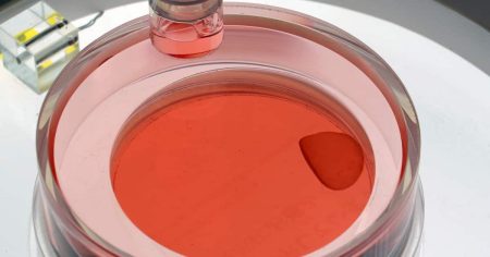 万博で見た夢が現実に　iPS細胞再生医療が社会実装「リハート」治験患者はゴルフ楽しむ - 産経ニュース